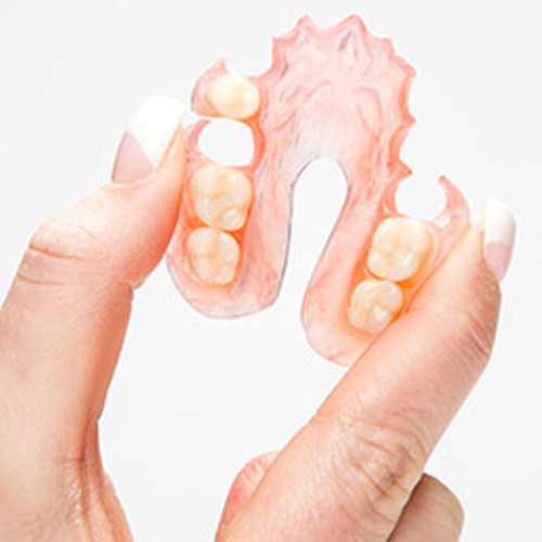 New Dentures What To Expect Pinckard AL 36371